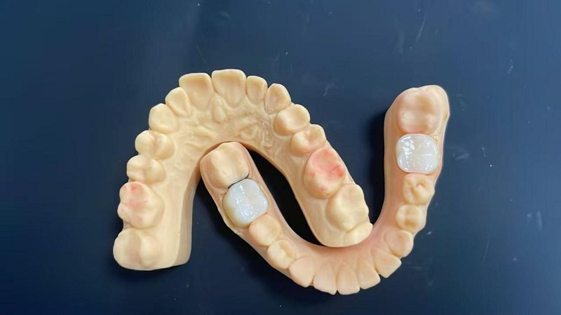 Zer da sorbalda ertza?