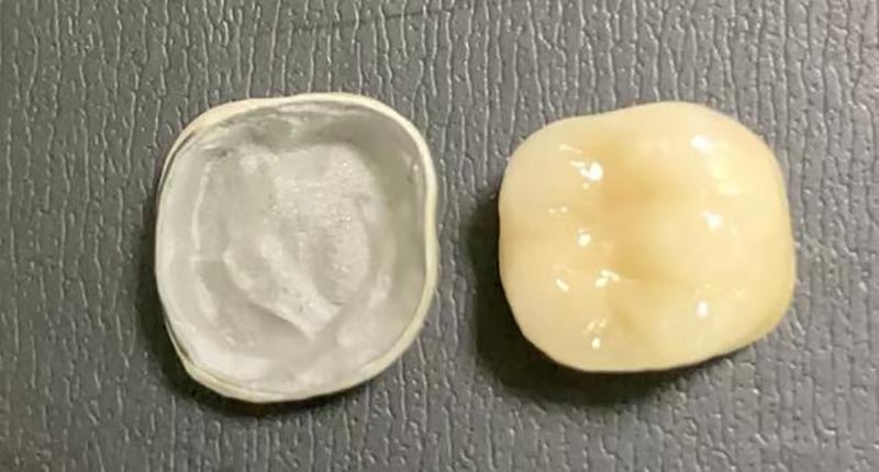 WM DENTAL LAB - Txinako hortz-laborategi liderra