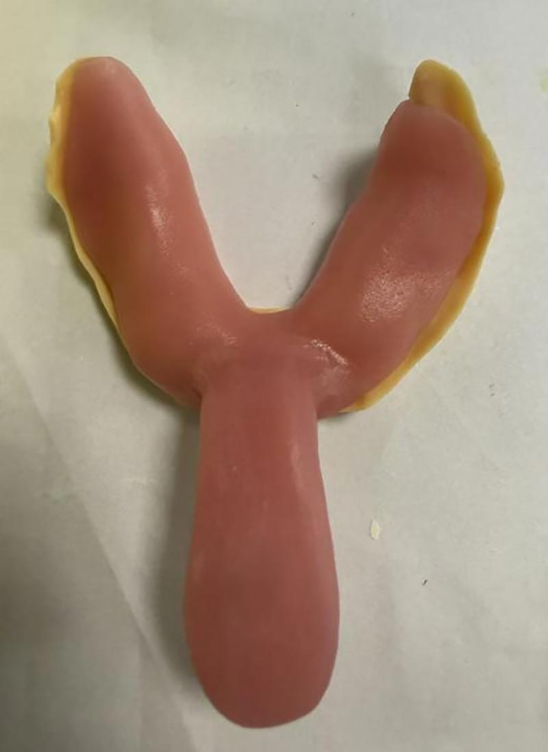 Hortz erretilu pertsonalizatuei buruz ezagutzen ez zenituen gauzak