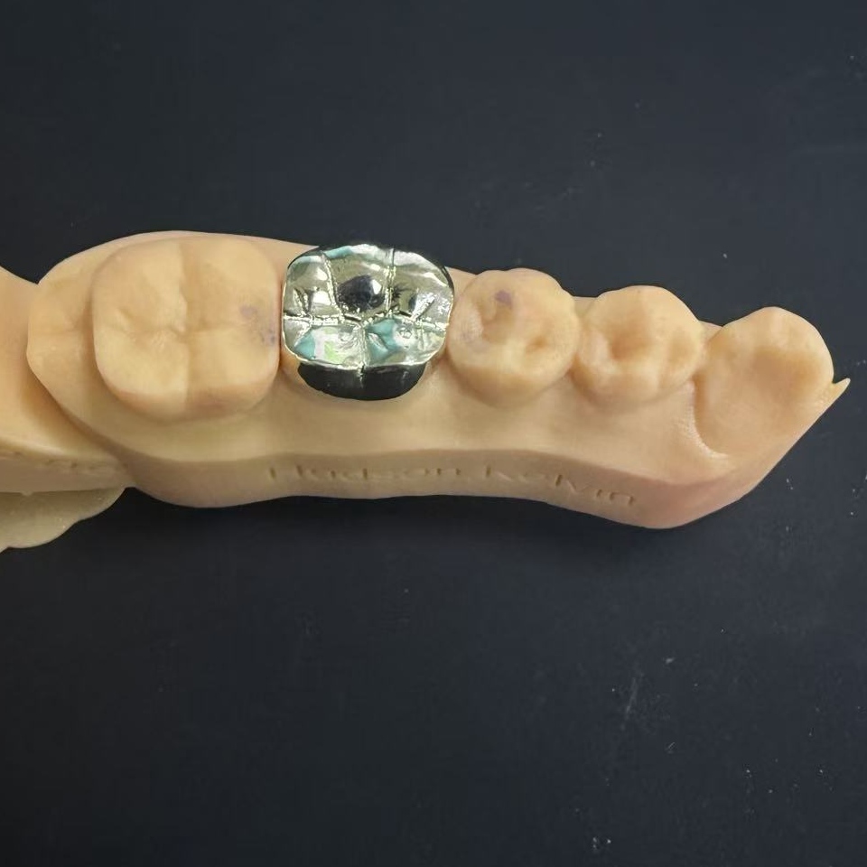 Urrezko koroak: betiko hortz zaharberritzerako metal preziatuen aukera