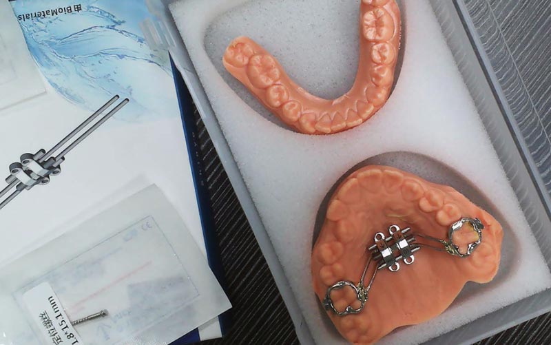 Ulertu MSE Skeletal Expansion WM Dental Lab-ekin