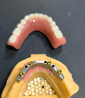 Bilatzailea eta hortz-barra